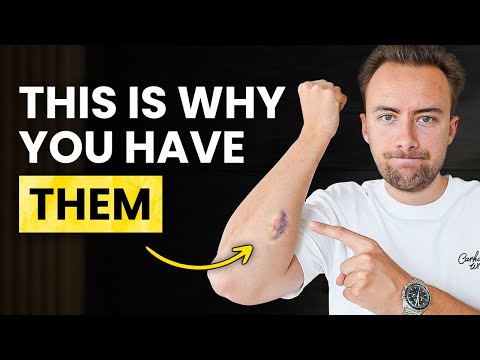 10 ADHD Behaviors That Make ZERO Sense (Until You Understand This)