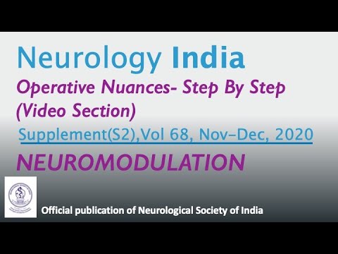 Robotic Guided Bilateral Cingulotomy for Treatment Resistant Obsessive Compulsive Disorder
