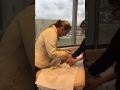 Catheter Removal After Hypospadias Repair With Dr Bush And Dr Snodgrass Of PARC Urology