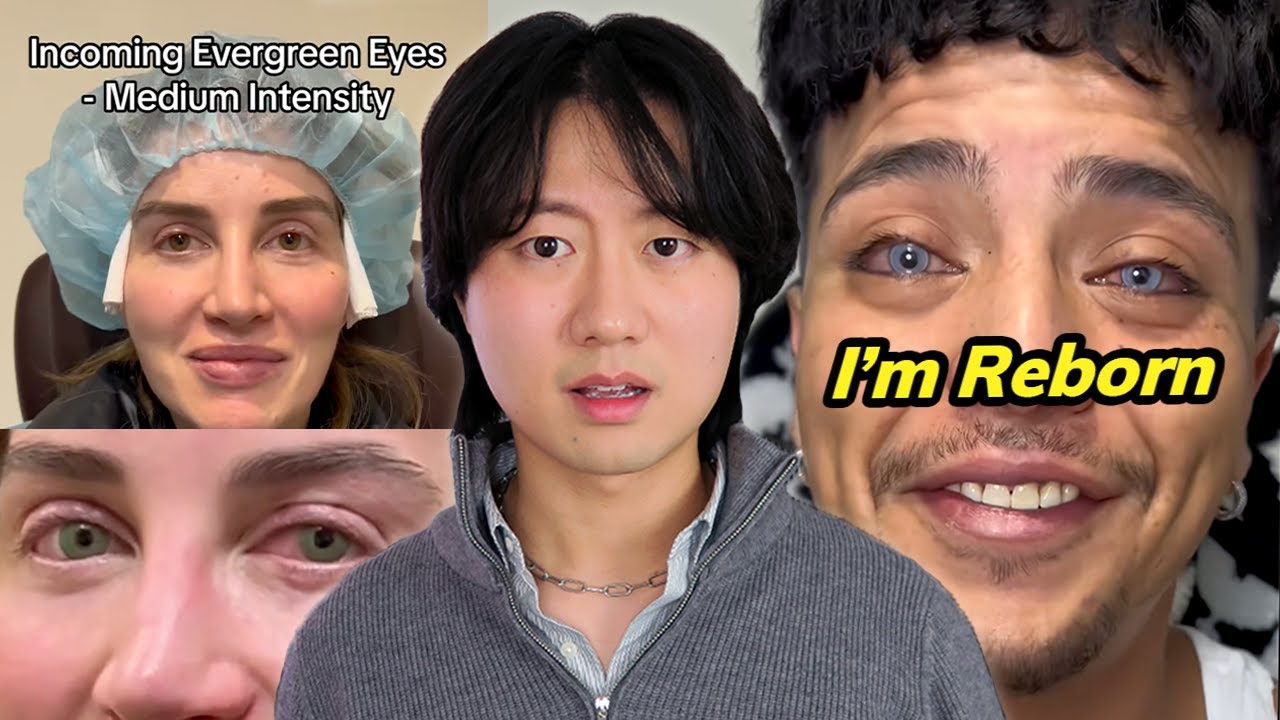 The Insane World of Eye Color Changing Surgeries