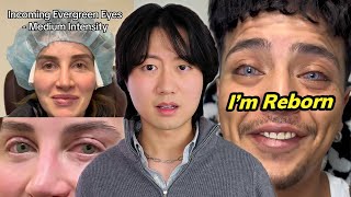 The Insane World of Eye Color Changing Surgeries MQDEFAULT Thumbnail