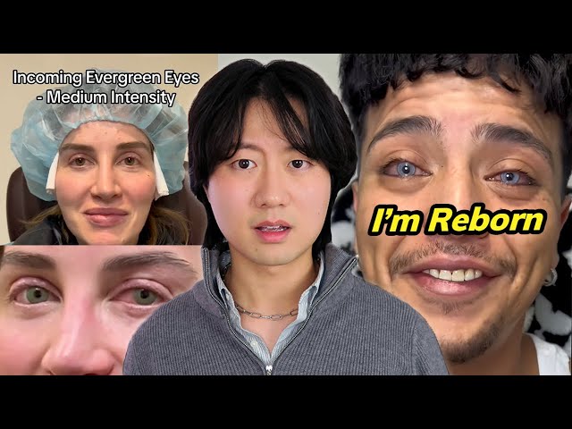 The Insane World of Eye Color Changing Surgeries SDDEFAULT Thumbnail