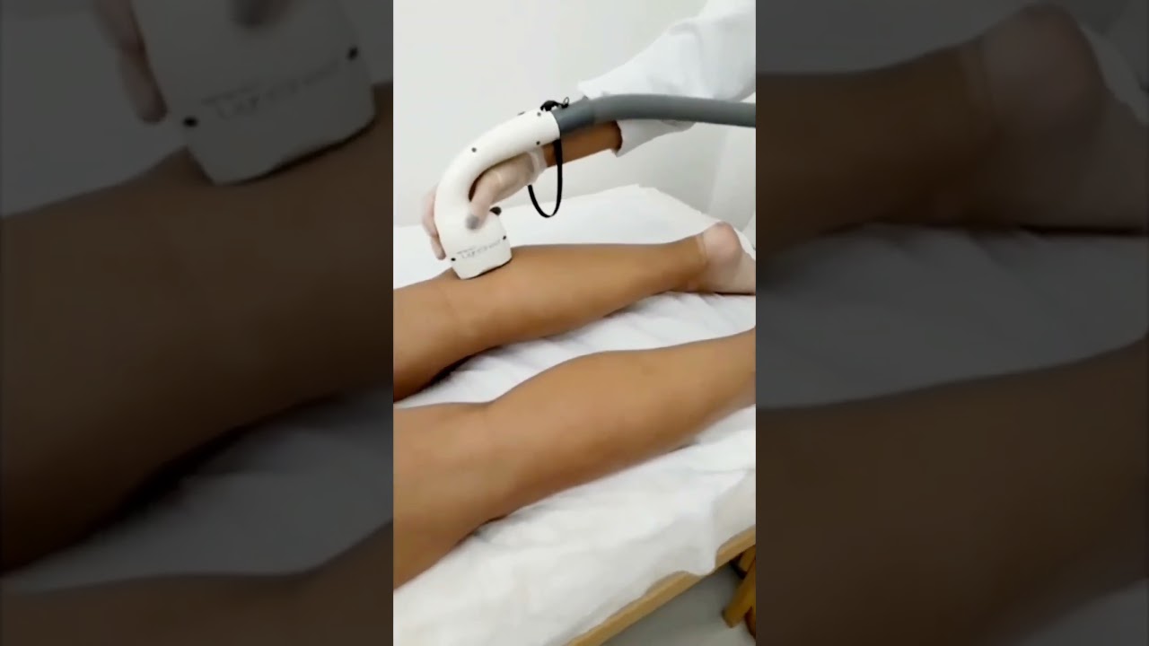 ADEUS PELOS 👋  DEPILAÇÃO A LASER COM LIGHT SHEER DUET  https://depilacaoalasercampinas.com.br
