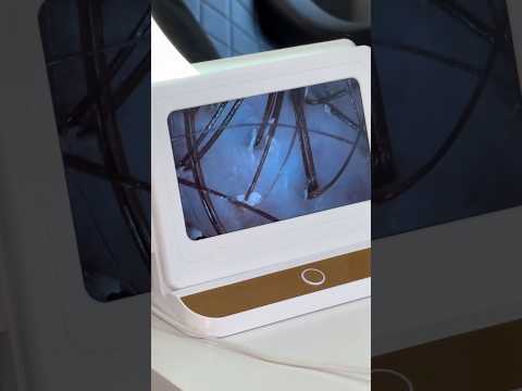 Трихоскоп Premium - фото 2 - id-p2261168341
