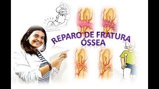 Reparo de Fratura Óssea Vídeo-aula n°9