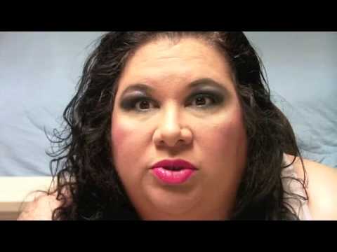 Life after an accident pt 1