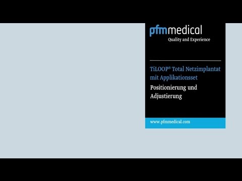 Animation: TiLOOP® PLUS-System (DE)