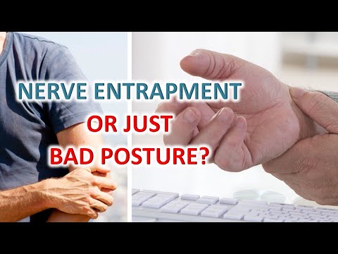 Ulnar Nerve Compression, CTS: Why You Should Improve Your Posture Today
