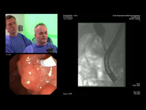 Wie Diabetiker Blutzucker zu reduzieren Zugewiesenen freie Medikamente für Diabetiker