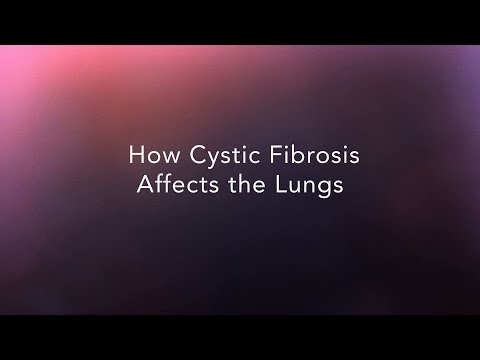 CF Foundation | How does cystic fibrosis affect the lungs?