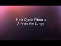 CF Foundation How Does Cystic Fibrosis Affect The Lungs