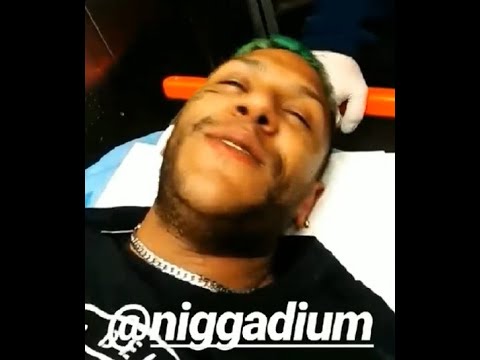 Nigga Dium parla del suo accoltellamento in una diretta su Instagram