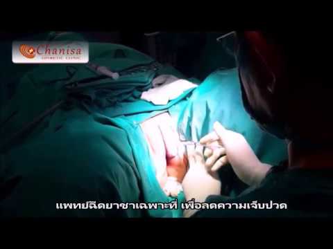 ลูกเพื่อเพิ่มความแข็งแรง ซึ่งเป็น Viagra ดีขึ้นหรือเชื้อโรคม้า