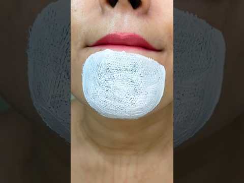 easy way to remove chin Whitehead & blackhead at home remedy♥️#shorts #youtubeshorts #trendinghacks