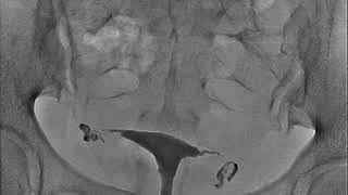 Download lagu Video HSG mp3 Download lagu Video HSG mp3