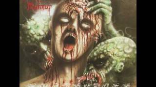 Disastrous Murmur - Extra Uterine Pregnancy (Part 2)