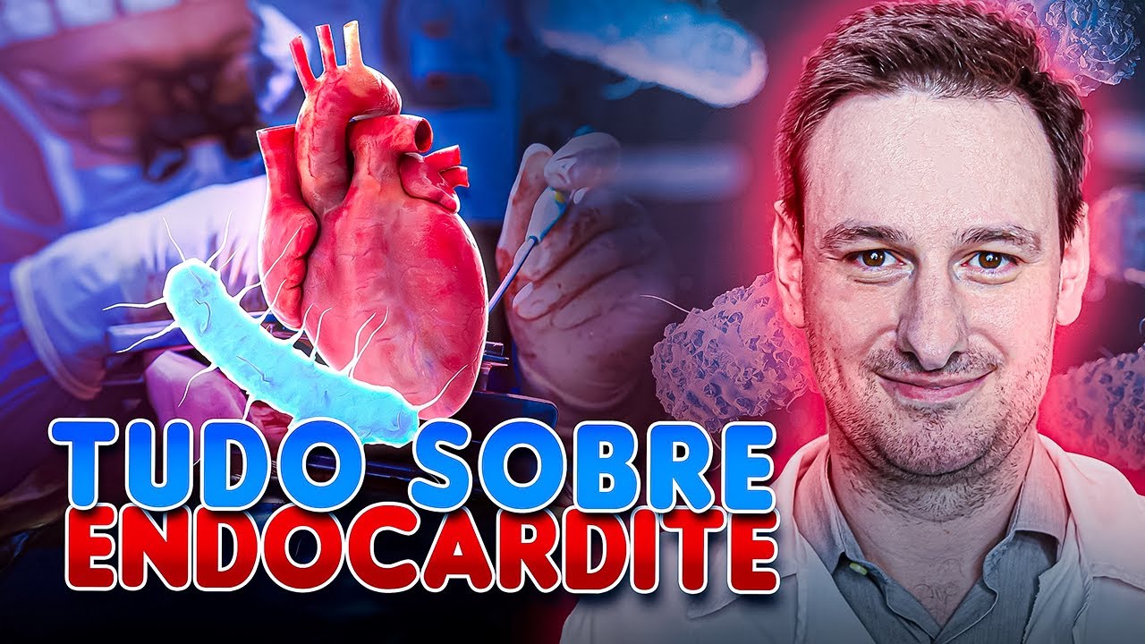 TUDO SOBRE ENDOCARDITE! CRITÉRIOS DE DUKE ATUALIZADOS 2023