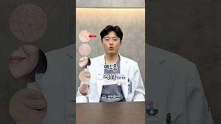 '이 시술' 로 피부 고민 해결!
