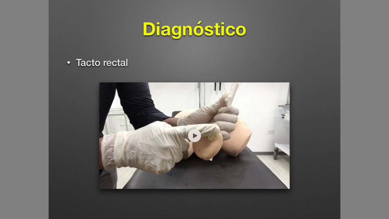 Cáncer de próstata