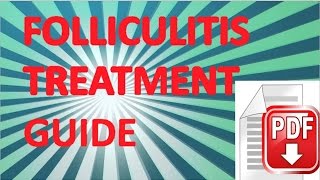 preview picture of video 'Folliculitis Treatment Guide and Advice'