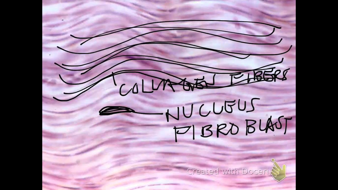 Connective Tissue Practice & Review