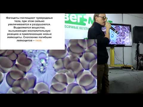 Гной, слизь и воспаления откуда берутся в нашем организме?Владимир Мастеров.Вред мяса,вегетерианство