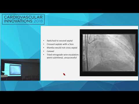 CVI2018 Session: Use of CTO PCI technique for salvage - Arslan Shaukat, MD