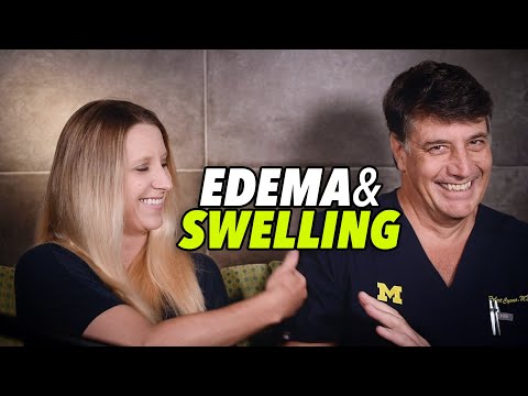 Ödeme und Schwellungen verstehen