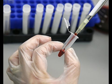 Prostata laser rimozione adenoma Come fare massaggio prostatico a raggiungere lorgasmo