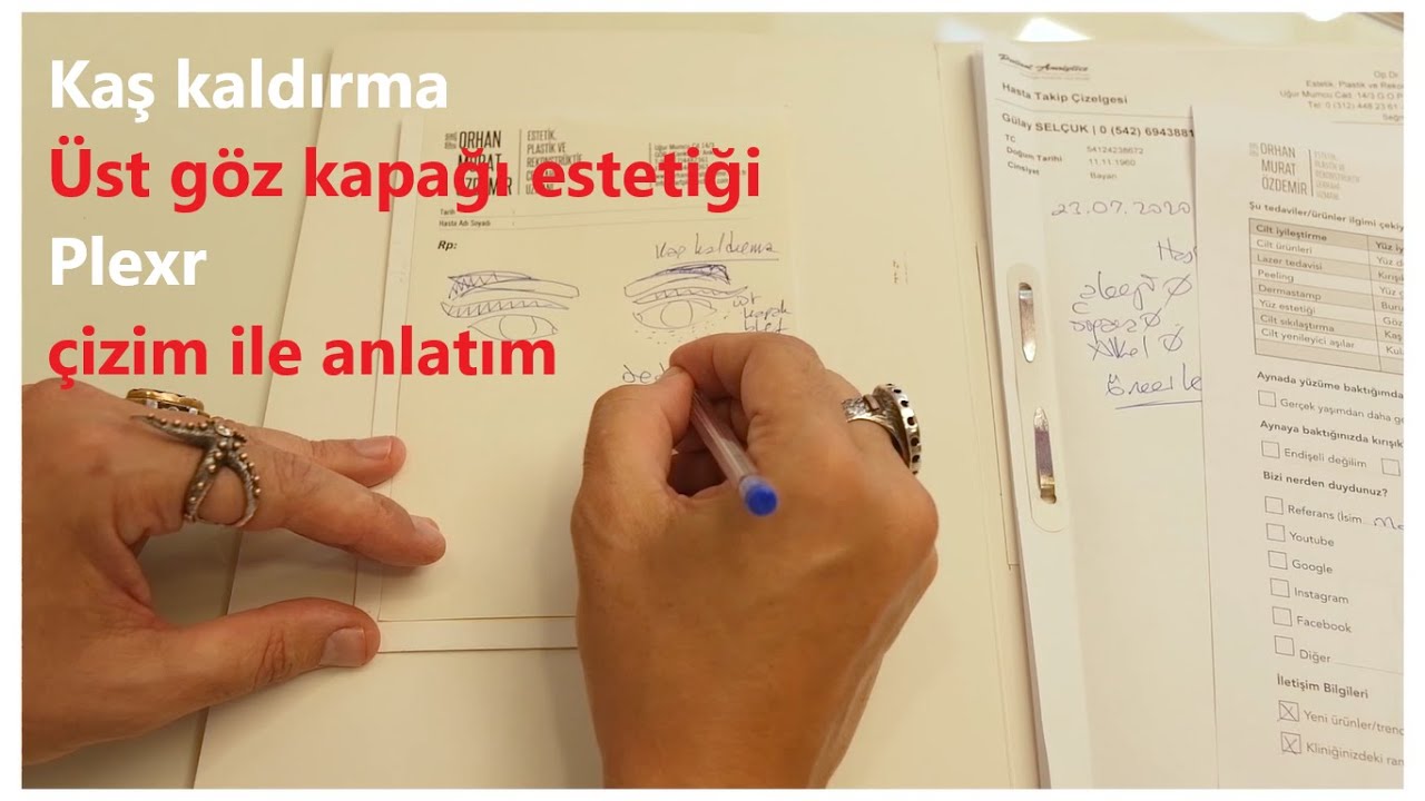 Kaş kaldırma, üst göz kapağı estetiği ve alt kapak Plexr uygulaması [Çizim ile anlatım]