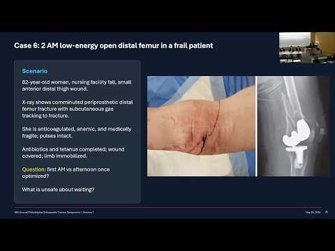 18th Annual Philadelphia Orthopaedic Trauma Symposium (POTS)