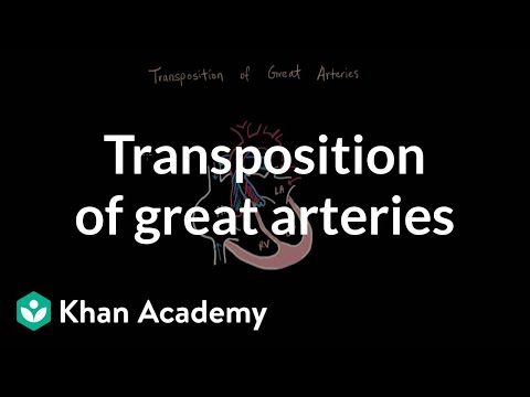Transposition of great arteries | Circulatory System and Disease | NCLEX-RN | Khan Academy