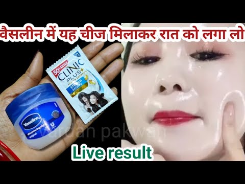 इस तरह से अपने चेहरे पर वैसलीन लगाएं और आपका चेहरा इतना गोरा हो जाएगा कि हर कोई देखेगा...
