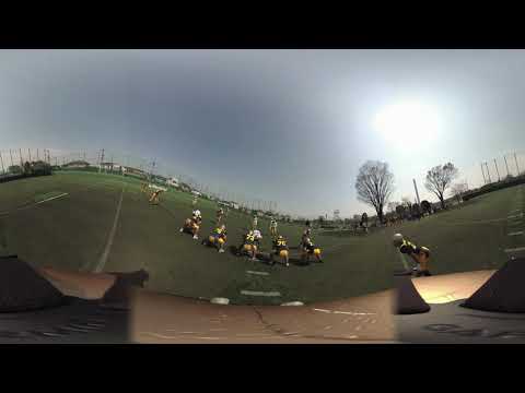 アメリカンフットボールでも使える:PupilScreenは脳損傷を診断するアプリ