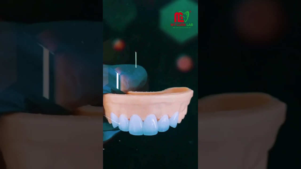Form Răng Đẹp Không Chỉ Là Màu Trắng–Mà Là Từng Chi Tiết Chuẩn Xác!