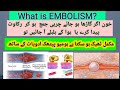 EMBOLISM Definition Types Etiology Symptoms Treatment With HOMEOPATHIC Medicine Doctor Abida
