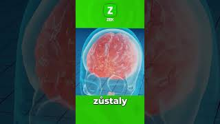 Download lagu Co se stane s naším mozkem po smrti? #shorts #mozek #smrt mp3 Download lagu Co se stane s naším mozkem po smrti? #shorts #mozek #smrt mp3