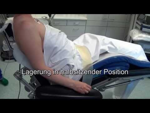 Betrieb am zervikalen Stenosen Kanal Rheumatoide Arthritis des Kniegelenks 2 Grad