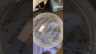 Clostridium difficile (C. diff) - Clinical Microbiology