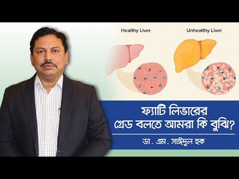 Fatty Liver Grade 1 - Fatty Liver Grade 2 - Fatty Liver Grade 3 - ফ্যাটি লিভারের গ্রেড