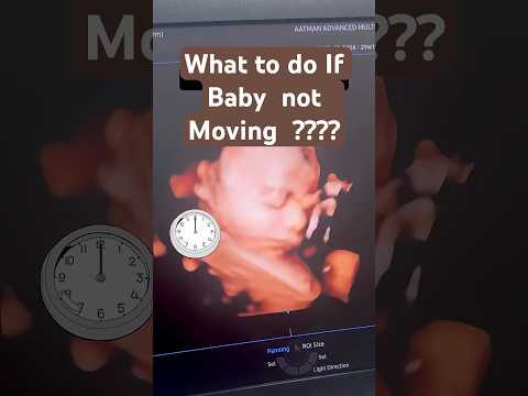 “Feeling less kicks? Your baby might just be… napping 😴” | Dr. RITU