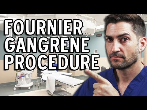 Fournier Gangrene Procedure - Brace Yourselves For This Story!
