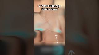 Lampert Md Plastic Surgery