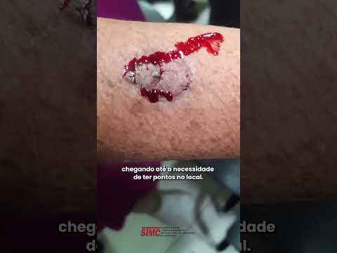 DIRETORA DO STMC É AGREDIDA PELA OPOSIÇÃO DURANTE A ASSEMBLEIA GERAL