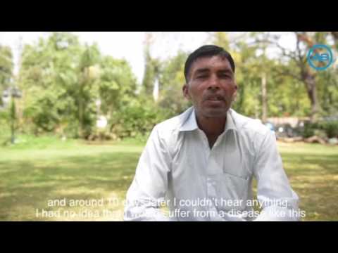 Cochlear implant educational video by DR SUMIT MRIG