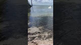 Flesh-eating bacteria claims 5 people in Florida