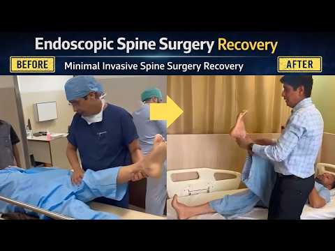 Endoscopic Spine Surgery Recovery | Minimal Invasive Spine Surgery Recovery | Dr. Ajay Kothari