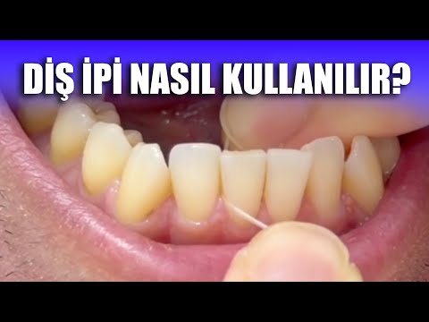 Çatal diş ipi kullanımı