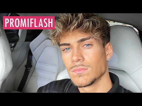 GNTM-Boy Ryan Wöhrl zeigt Ergebnisse von Haartransplantation