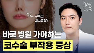 [Dr.유퀴즈온더바이브] 코수술 후 부작용, 내 코는 안전할까? 구축, 염증, 휘어짐 판단법!｜코성형 부작용 증상 Q&A